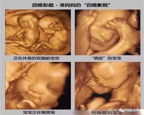 胎儿在肚子里的姿势 分娩时胎儿是海战单机游戏