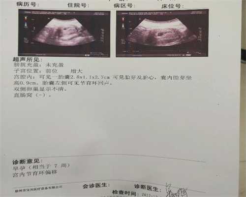 代孕七个月左侧睡好还是右侧睡好_哈尔滨医院
