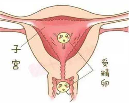 国内代生孩子-怎样可以检查宫外孕