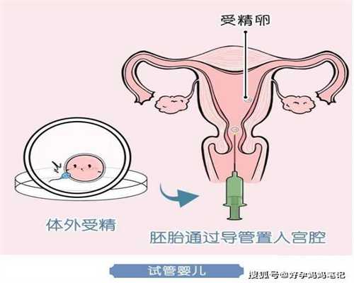 北京代生小孩费用-孕妇产后尿失禁怎么办