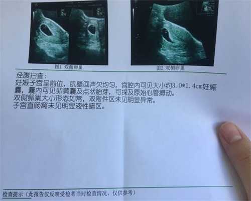 北京找人代生孩子价格-怀孕初期小腹隐隐作痛或是这五种原因
