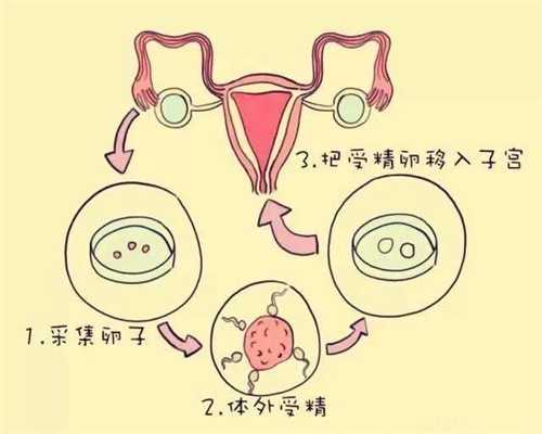 北京代怀孕第四代试管-哪些饮食可增加试管婴儿成功率？
