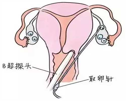 北京去哪找女人代孕：金花菜