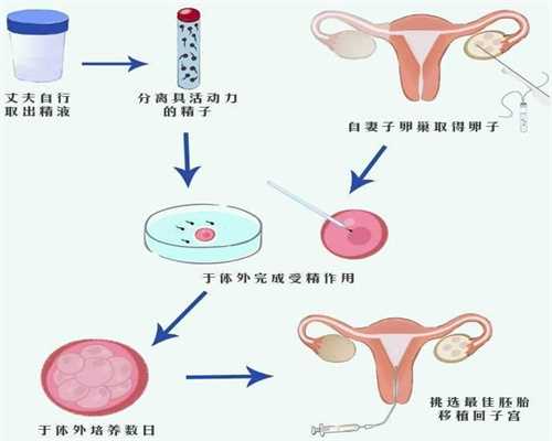 北京2021年洗精代孕：孕期胎儿入盆早晚和分娩时间有关系吗