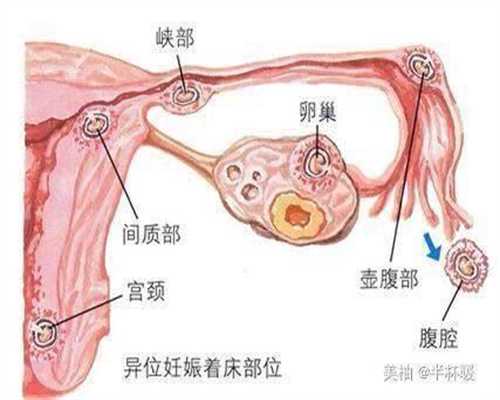 北京代孕的费用如何：北京哪里有代孕的机构：青枣是热性还是凉性