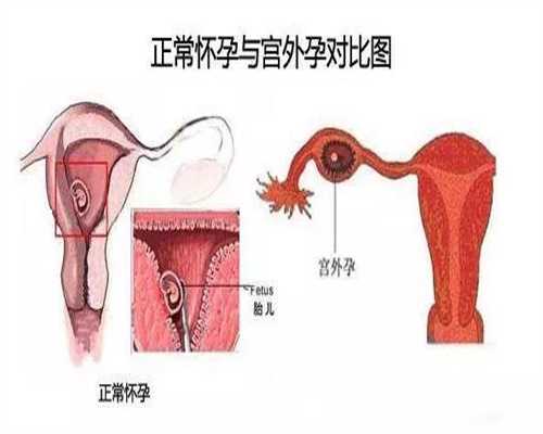 北京代孕服务的方式：北京代孕产子的协议怎么写：1617678433496