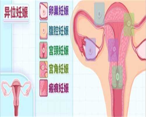 北京想找个代孕机构：北京代孕孩子费用：羊水没了胎儿能活多久