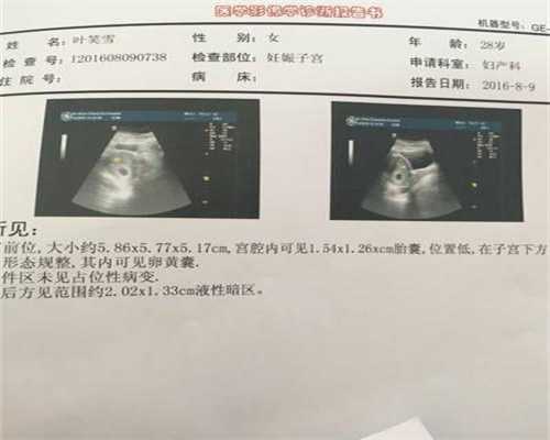 北京代孕机构联系方式-37岁河北姐妹试管3次都没成功，要做几次才怀孕？听听