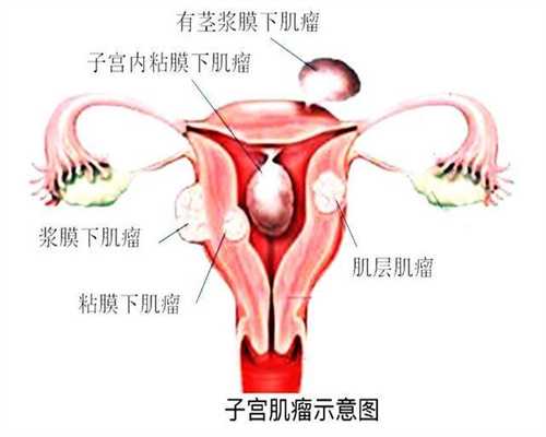 北京借卵代孕生男孩多少钱_北京代孕国际生殖中心