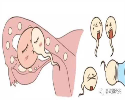 北京代孕价位_北京在的医院可以做代孕手术吗
