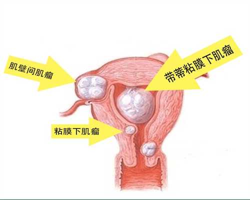 北京怎么才能找到代孕的人_北京代孕试管要多少钱