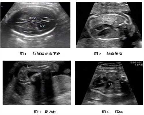 北京供卵助孕包成功_找自然代生小小孩女人_准备怀孕和补充叶酸有什么压力？