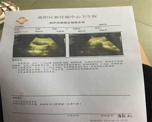 北京医院做供卵的费用是多少_北京供卵试管费用_供卵福梦试管婴儿卵子交易黑