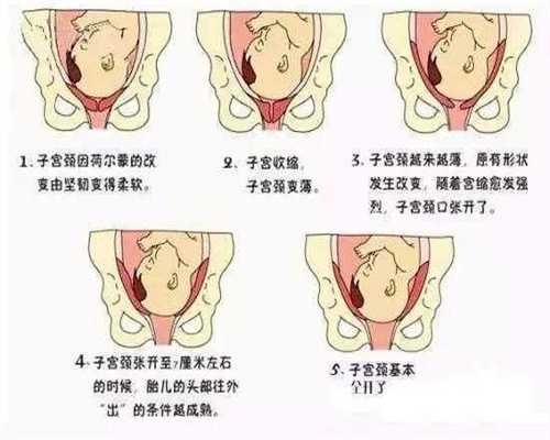 北京本地供卵医院_如何选择供卵女_南方生殖医疗机构，南方生殖备孕男孩成功
